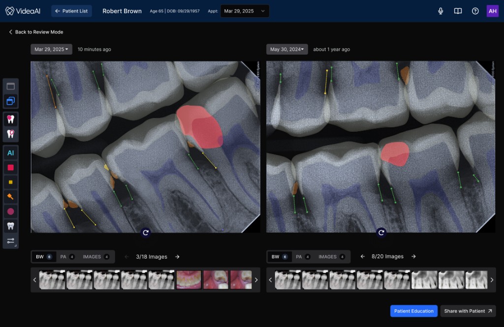 Compare View — side-by-side radiograph comparison