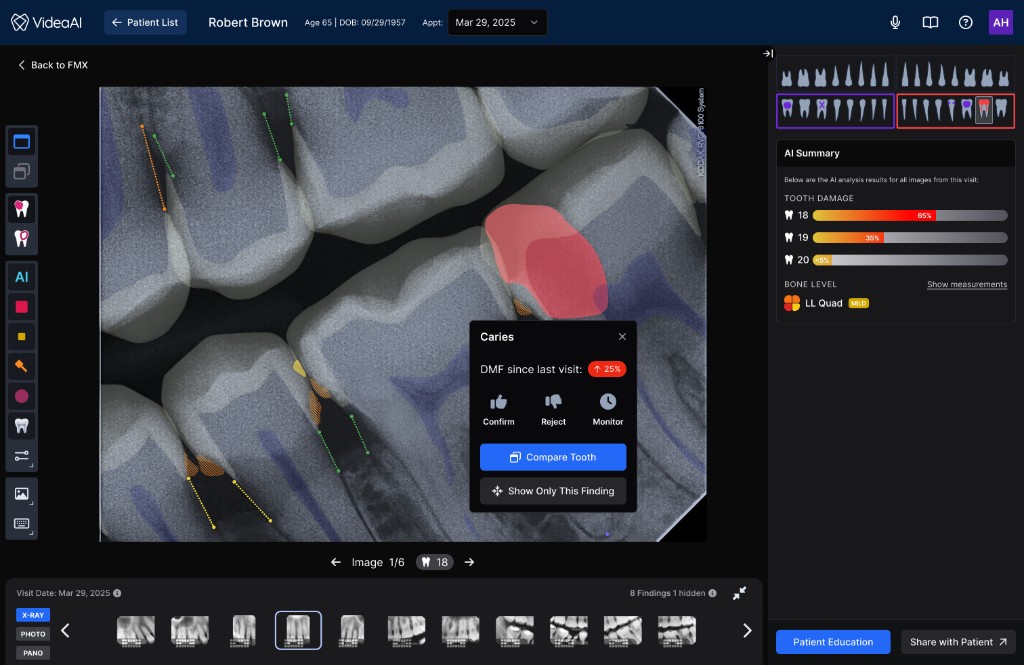 Finding Detail — AI-assisted diagnosis with contextual actions
