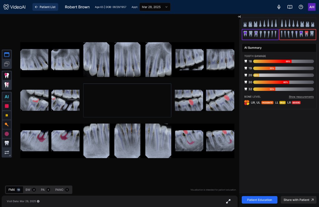 Redesigned Viewer — three-panel clinical interface